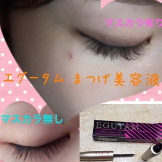 エグータム 箱無し 即購入×(まつ毛美容液)
