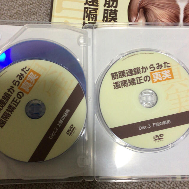 筋膜連鎖からみた遠隔矯正の真実 DVD