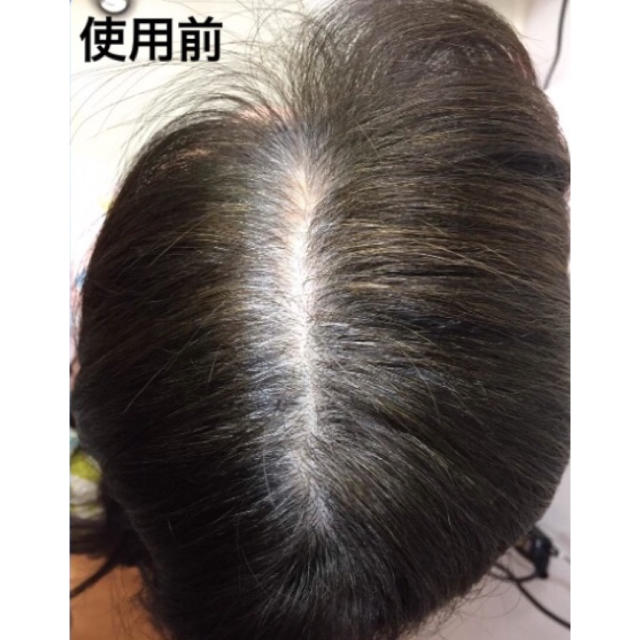 白髪生え際 分け目かくし つむじ 頭頂部ボリュームアップヘアーファンデーションの通販 By Nlcc S Shop ラクマ 白髪生え際 分け目かくし つむじ 頭頂部ボリュームアップヘアーファンデーションの通販 By Nlcc S Shop ラクマ