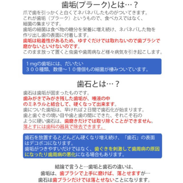 【☆１番人気☆】歯石取り 丈夫なステンレス製 No.67 コスメ/美容のオーラルケア(口臭防止/エチケット用品)の商品写真