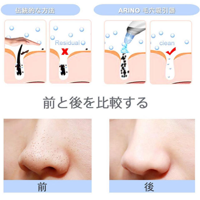 毛穴吸引器 イチゴ鼻 毛穴 角栓 黒ずみ ニキビ 除去 フェイスケア 角質ケアの通販 By 全品新品 新品に近いですよ ラクマ