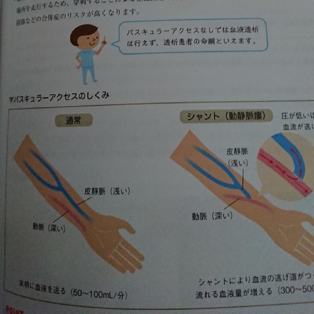 人工透析看護本 エンタメ/ホビーの本(健康/医学)の商品写真