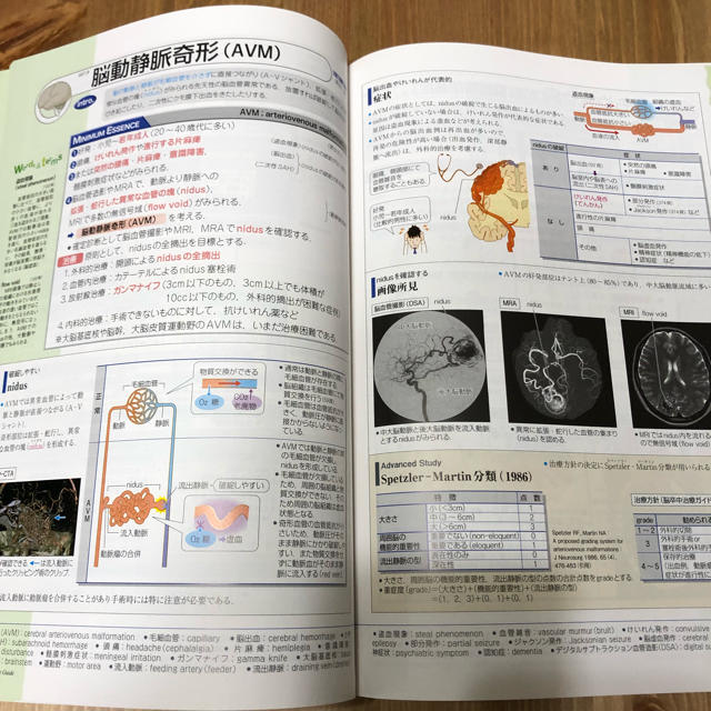 病気がみえる vol.7 脳・神経 エンタメ/ホビーの本(語学/参考書)の商品写真