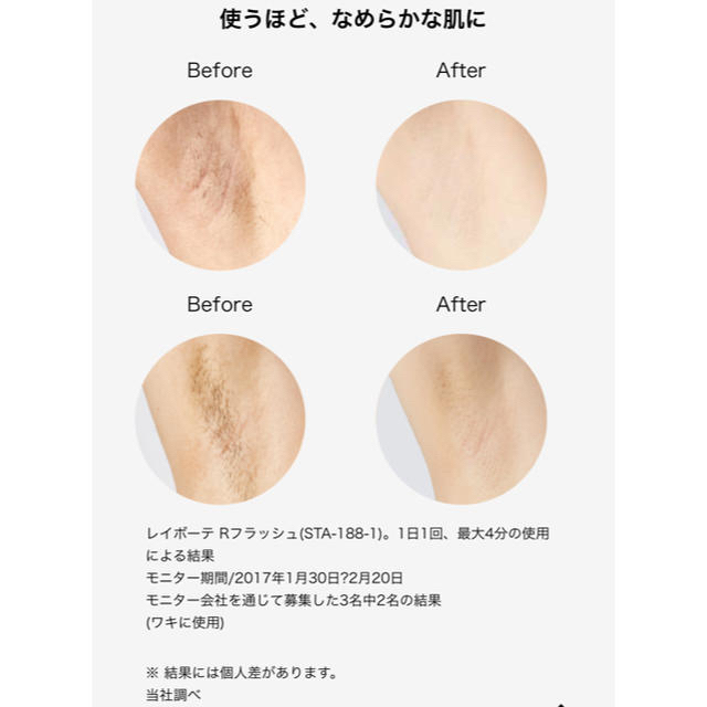 家庭用脱毛器　ヤーマン レイボーテRフラッシュ　PLUS for salon