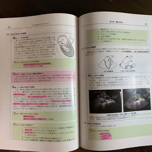 初心者から研修医のための経食道心エコー 2 部長も科長ももう初級者