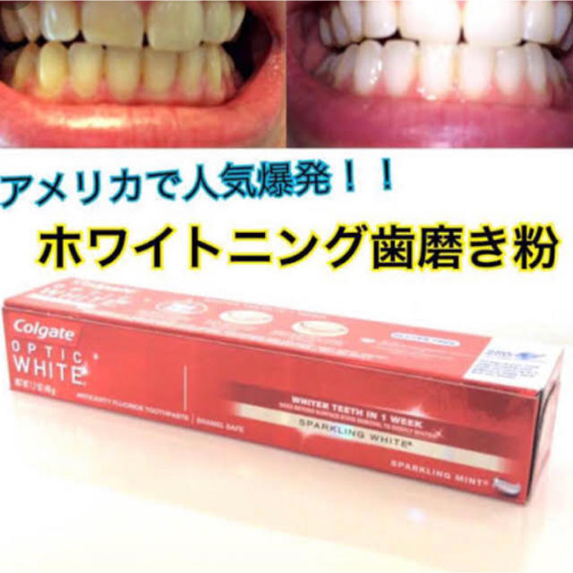 Crest 新品正規 コルゲート Colgate 歯磨き粉 ホワイトニング マスプロ Nbaの通販 By Stuck Jp S Shop クレスト ならラクマ