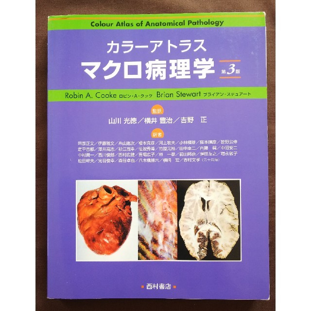 看護師資格テキスト カラーアトラス マクロ病理学 第３版