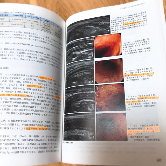 腹部超音波テキスト 日超検