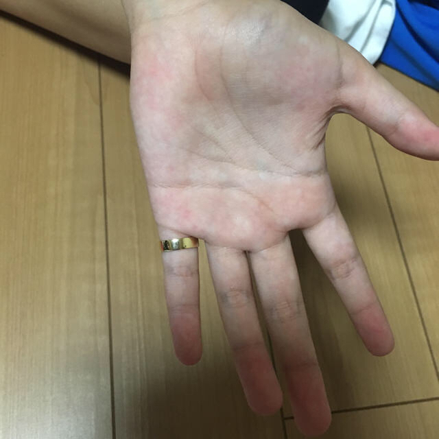 ゆうき様専用です。購入は控えて下さい レディースのアクセサリー(リング(指輪))の商品写真