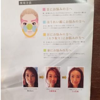 pico 小顔スティック Lara ララ 美顔鍼 美顔器