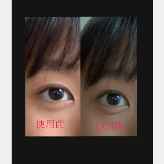 くっきり二重 ぷっくり涙袋 夜の癖付にも 使用した人の感想あります の通販 By プロフ必読 S Shop ラクマ くっきり二重 ぷっくり涙袋 夜の癖付にも 使用した人の感想あります の通販 By プロフ必読 S Shop ラクマ