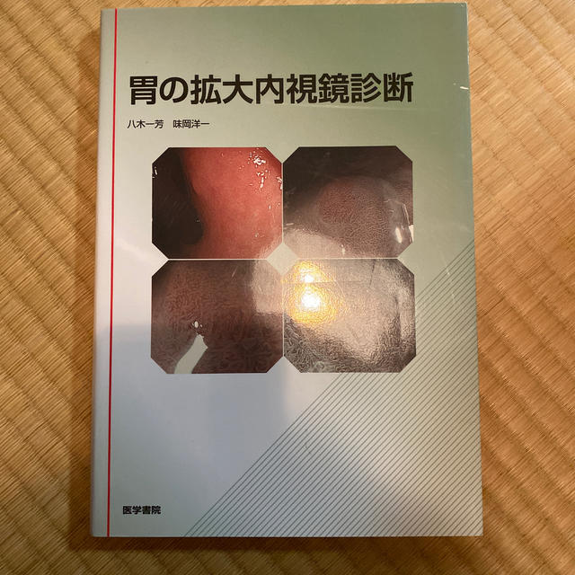 胃の拡大内視鏡診断