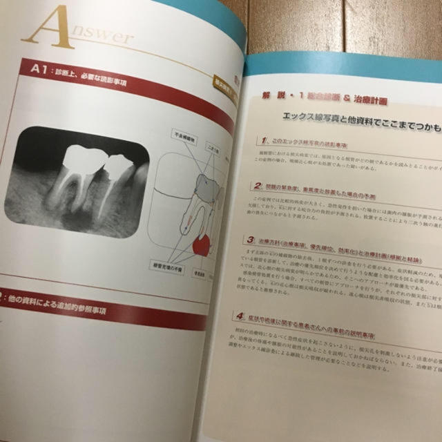 エックス線診断を100%臨床で活用するには  口腔病変 2冊 エンタメ/ホビーの本(健康/医学)の商品写真