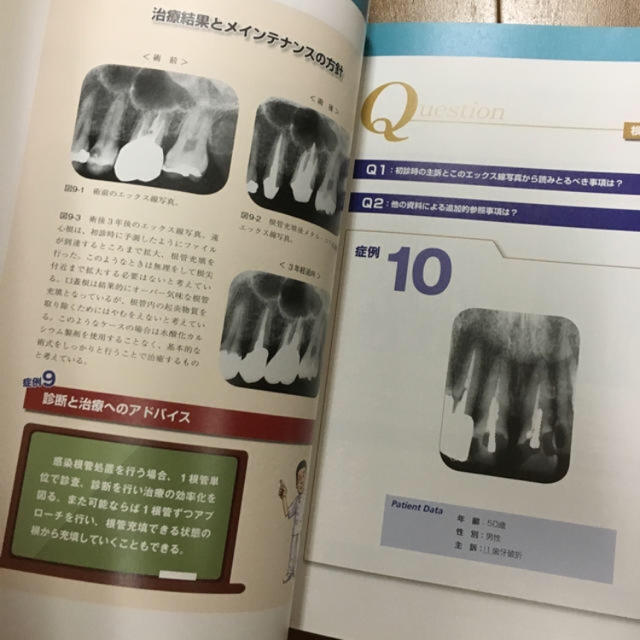 エックス線診断を100%臨床で活用するには  口腔病変 2冊 エンタメ/ホビーの本(健康/医学)の商品写真