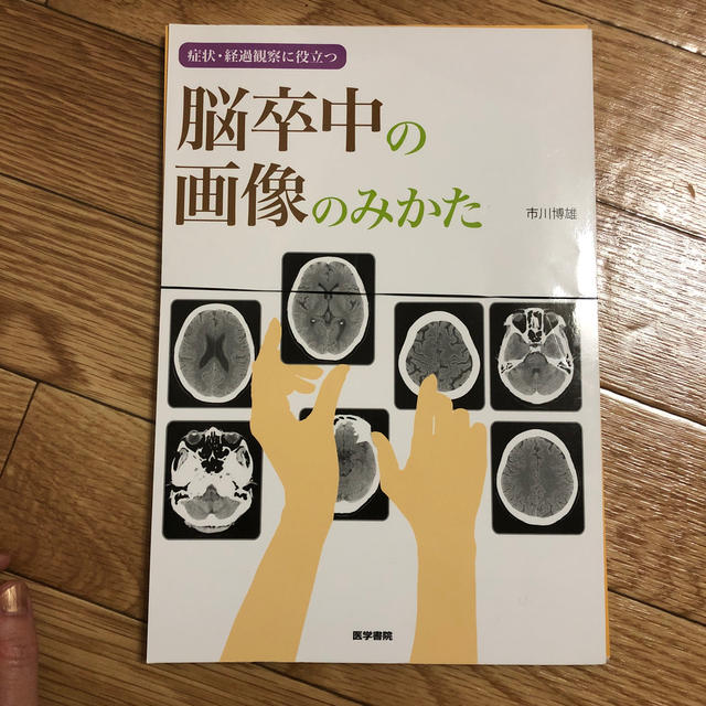 脳卒中の画像のみかた　裁断済み エンタメ/ホビーの本(健康/医学)の商品写真