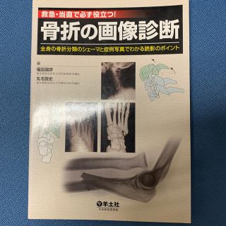 救急・当直で必ず役立つ！骨折の画像診断(健康/医学)