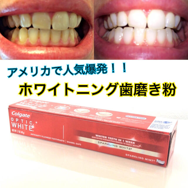 【新品】海外人気♡ホワイトニング歯磨き粉 コスメ/美容のオーラルケア(マウスウォッシュ/スプレー)の商品写真