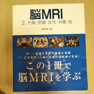 脳ＭＲＩ ２(健康/医学)