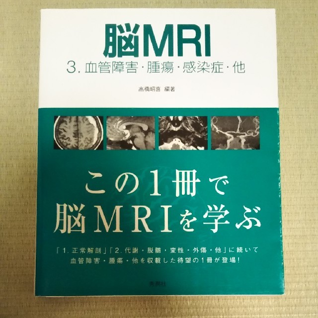 高橋昭喜専用　脳ＭＲＩ ３