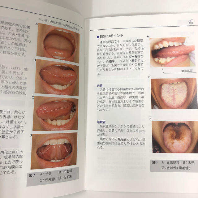 がん治療における口腔粘膜支持療法の為の口腔粘膜炎評価マニュアル エンタメ/ホビーの本(健康/医学)の商品写真