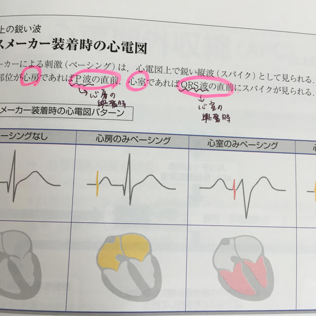 病気がみえる チーム医療を担う医療人共通のテキスト ｖｏｌ．２ 改訂第４版 エンタメ/ホビーの本(健康/医学)の商品写真