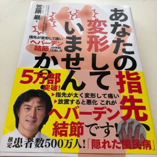 あなたの指先、変形していませんか？ 指先が変形して痛い「ヘバーデン結節」の予防と(健康/医学)