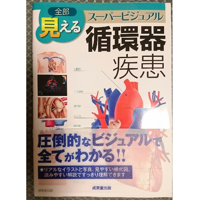 全部見える循環器疾患 スーパービジュアル エンタメ/ホビーの本(健康/医学)の商品写真