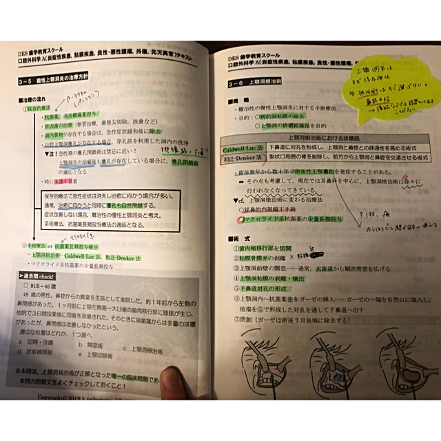 最新　DES 113回歯科医師国家試験　本科生　教材セット