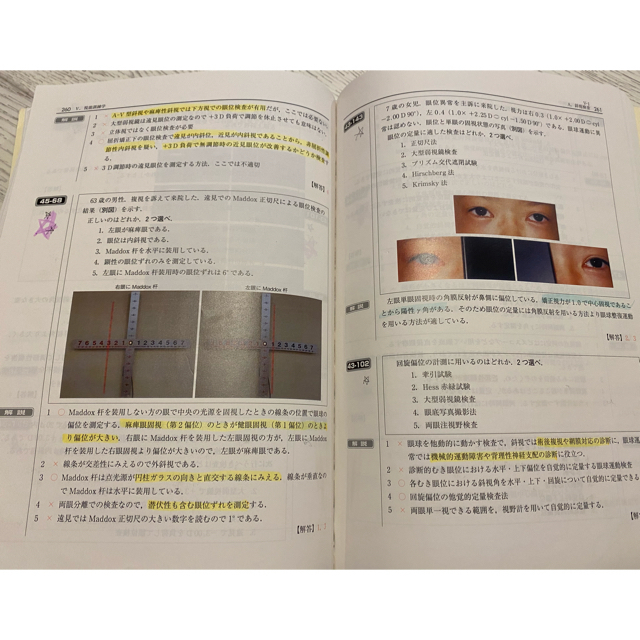 視能訓練士 国家試験過去問題集 43〜48回 | hmgrocerant.com 視能訓練士 国家試験過去問題集 43〜48回 | hmgrocerant.com