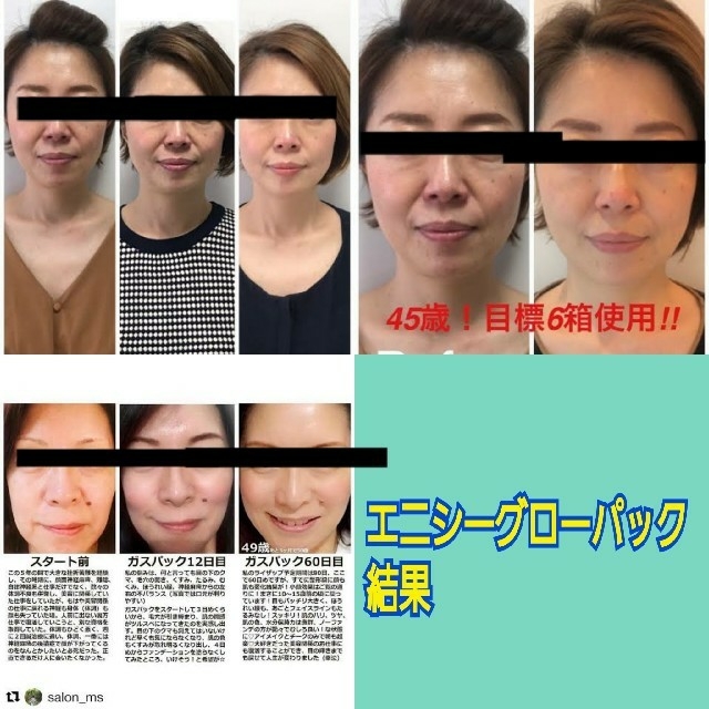 値引きしました!!!!】エニシーグローパック www.krzysztofbialy.com