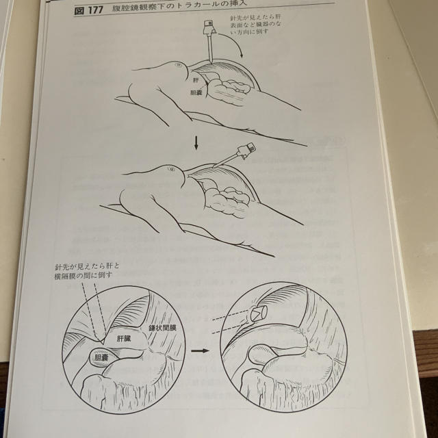 裁断済　前立ちからみた消化器外科手術 エンタメ/ホビーの本(健康/医学)の商品写真