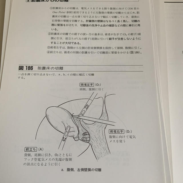 裁断済　前立ちからみた消化器外科手術 エンタメ/ホビーの本(健康/医学)の商品写真