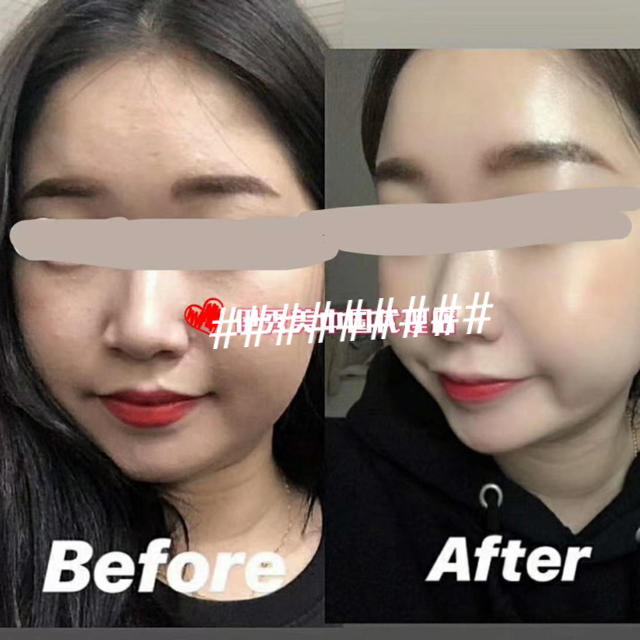 INCELLDERM インセルダム ミニサイズ 7点セットx2 新品未開封・お得の通販 by とぅあん 韓国製化粧品店 |ラクマ INCELLDERM インセルダム ミニサイズ 7点セットx2 新品未開封・お得の通販 by とぅあん 韓国製化粧品店 |ラクマ