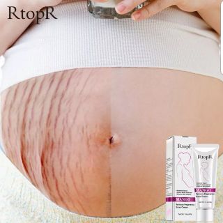妊娠線予防、修復クリーム　RtopR(妊娠線ケアクリーム)