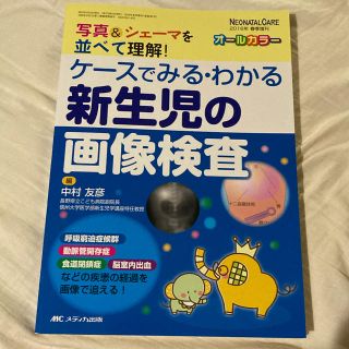 ケ－スでみる・わかる新生児の画像検査 写真＆シェ－マを並べて理解！(健康/医学)