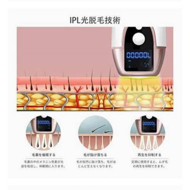 脱毛器レーザー 永久脱毛 IPL光脱毛器 家庭用 70万回フラッシュ 5段階照射