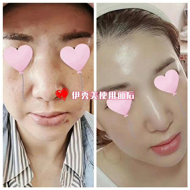 あい様専用 Incellderm インセルダム 3点セット✖️2 あい様専用 Incellderm インセルダム 3点セット✖️2