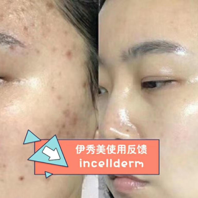あい様専用 Incellderm インセルダム 3点セット✖️2 あい様専用 Incellderm インセルダム 3点セット✖️2