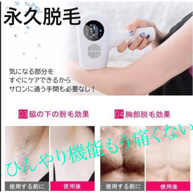 新品　脱毛器 光脱毛 無痛 全身用 フラッシュ レーザー 脱毛 IPL 美肌