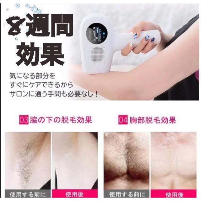 新品　脱毛器 光脱毛 無痛 全身用 フラッシュ レーザー  脱毛 IPL 美肌脱毛/除毛剤