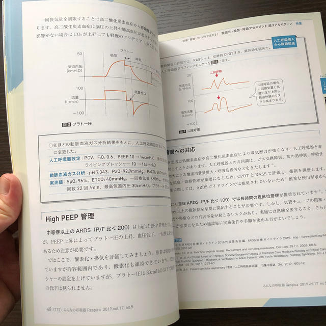 みんなの呼吸器Ｒｅｓｐｉｃａ 呼吸療法の現場を支える専門誌 Ｖｏｌ．１７　ｎｏ． エンタメ/ホビーの本(健康/医学)の商品写真