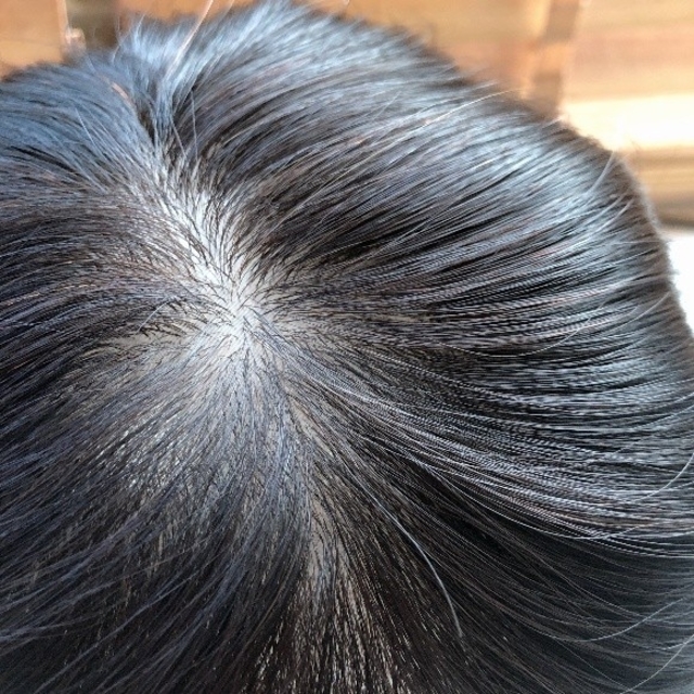 人毛100% 部分ウィッグ ヘアピース 薄毛 白髪 医療用 ボリュームの通販 by 医療用ウイッグと帽子のシロ*ファクトリー｜ラクマ