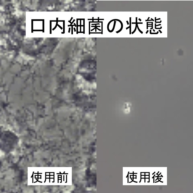 3  口臭シャットアウト水　口臭予防　口臭ケア　口臭チェッカー　歯周病 コスメ/美容のオーラルケア(口臭防止/エチケット用品)の商品写真