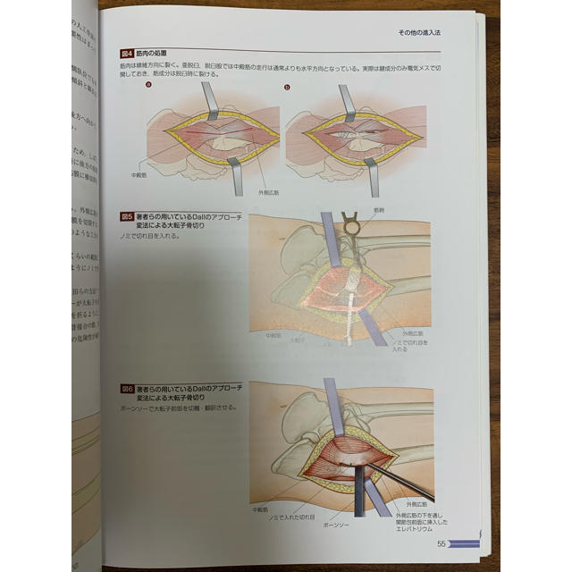 全人工股関節置換術のすべて エンタメ/ホビーの本(健康/医学)の商品写真