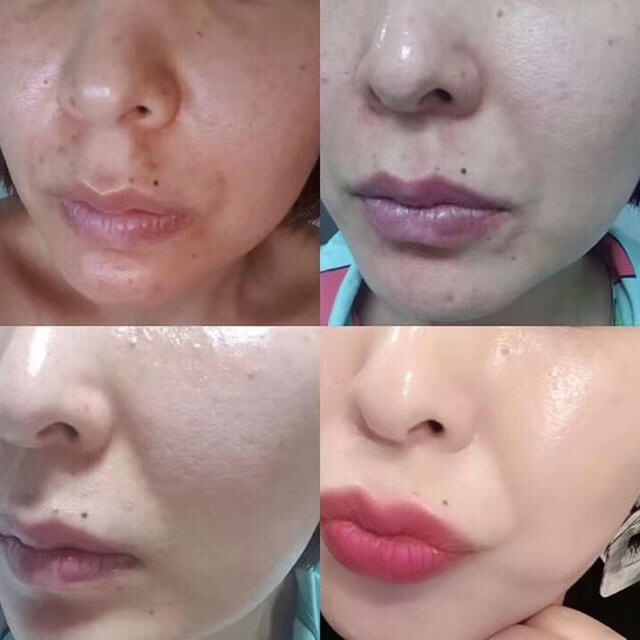 有名な高級ブランド 正規品 incellderm インセルダム 基礎5点セット