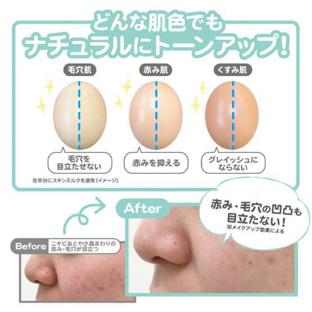 ettusais(エテュセ)のエテュセ　スキンミルク　乳液　ニキビ コスメ/美容のスキンケア/基礎化粧品(乳液/ミルク)の商品写真