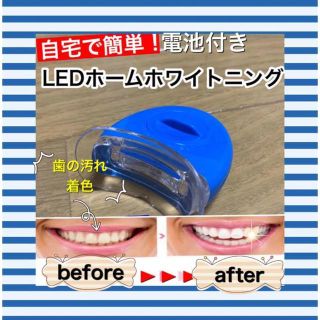 【電池付】LED歯科ホームホワイトニング/セルフホワイトニング(その他)