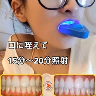 ホワイトニング  LEDライト　ホームホワイトニング  セルフホワイトニング  (口臭防止/エチケット用品)