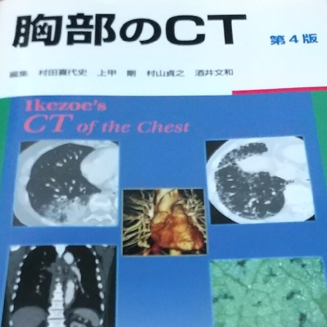 胸部のＣＴ 第４版放射線診断