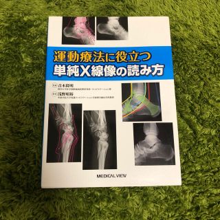 【値下げ中】運動療法に役立つ単純Ｘ線像の読み方(健康/医学)